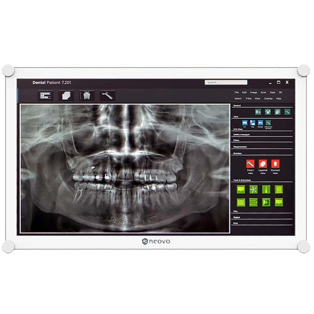 AG Neovo DR-2202 22" Dental LCD Monitor